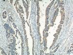 Caldesmon Antibody in Immunohistochemistry (Paraffin) (IHC (P))