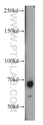 Caldesmon Antibody in Western Blot (WB)