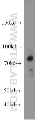 Caldesmon Antibody in Western Blot (WB)