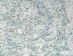 SLC16A4 Antibody in Immunohistochemistry (Paraffin) (IHC (P))