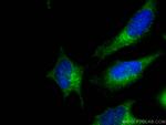 SEC23IP Antibody in Immunocytochemistry (ICC/IF)