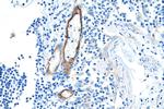 E-selectin /CD62E Antibody in Immunohistochemistry (Paraffin) (IHC (P))