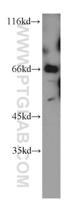 E-selectin /CD62E Antibody in Western Blot (WB)