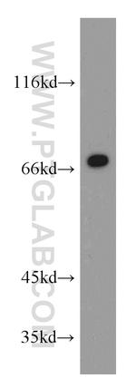 E-selectin /CD62E Antibody in Western Blot (WB)