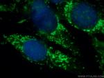 BRAF Antibody in Immunocytochemistry (ICC/IF)