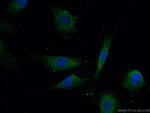 BRAF Antibody in Immunocytochemistry (ICC/IF)