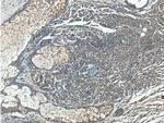 BRAF Antibody in Immunohistochemistry (Paraffin) (IHC (P))