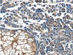 BRAF Antibody in Immunohistochemistry (Paraffin) (IHC (P))