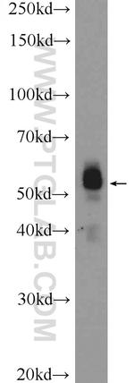 BRAF Antibody in Western Blot (WB)