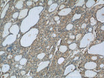 BRAF Antibody in Immunohistochemistry (Paraffin) (IHC (P))