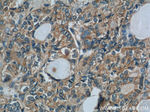 BRAF Antibody in Immunohistochemistry (Paraffin) (IHC (P))