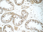 BRAF Antibody in Immunohistochemistry (Paraffin) (IHC (P))