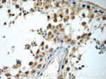 BRAF Antibody in Immunohistochemistry (Paraffin) (IHC (P))