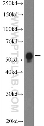 BRAF Antibody in Western Blot (WB)