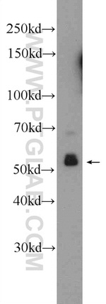 BRAF Antibody in Western Blot (WB)