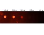 CRP Antibody in Dot Blot (DB)