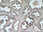 C3orf21 Antibody in Immunohistochemistry (Paraffin) (IHC (P))