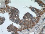 C3orf21 Antibody in Immunohistochemistry (Paraffin) (IHC (P))