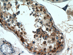 WDR37 Antibody in Immunohistochemistry (Paraffin) (IHC (P))