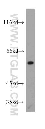 WDR37 Antibody in Western Blot (WB)