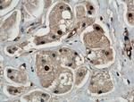 ITCH Antibody in Immunohistochemistry (Paraffin) (IHC (P))