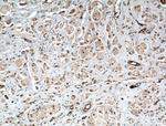 ITCH Antibody in Immunohistochemistry (Paraffin) (IHC (P))