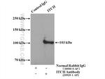 ITCH Antibody in Immunoprecipitation (IP)