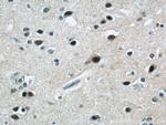 ZNF597 Antibody in Immunohistochemistry (Paraffin) (IHC (P))