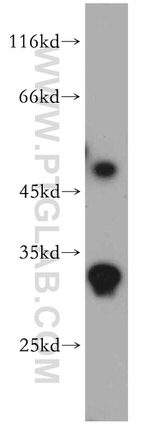 ZNF597 Antibody in Western Blot (WB)