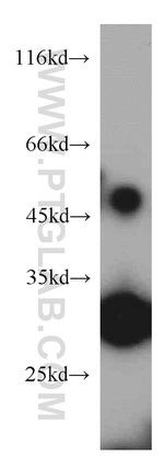 ZNF597 Antibody in Western Blot (WB)