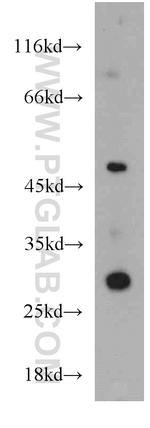 ZNF597 Antibody in Western Blot (WB)