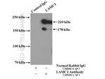 LAMC1 Antibody in Immunoprecipitation (IP)