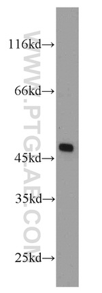 BEND5 Antibody in Western Blot (WB)