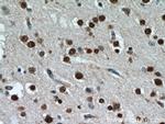 TBR1 Antibody in Immunohistochemistry (Paraffin) (IHC (P))