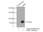 TBR1 Antibody in Immunoprecipitation (IP)