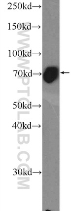 TBR1 Antibody in Western Blot (WB)