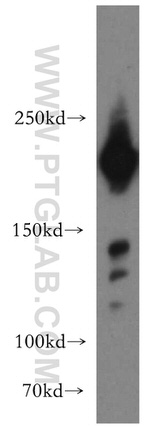 PHIP Antibody in Western Blot (WB)