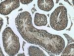 DPCD Antibody in Immunohistochemistry (Paraffin) (IHC (P))