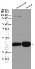 DPCD Antibody in Western Blot (WB)