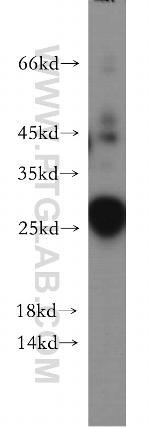 DPCD Antibody in Western Blot (WB)