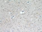 C1orf83 Antibody in Immunohistochemistry (Paraffin) (IHC (P))