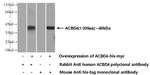 ACBD4 Antibody in Western Blot (WB)