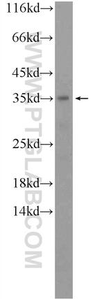 ACBD4 Antibody in Western Blot (WB)