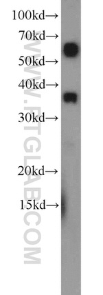 ZC3HAV1L Antibody in Western Blot (WB)