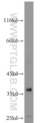 ZC3HAV1L Antibody in Western Blot (WB)