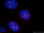 ABHD14B Antibody in Immunocytochemistry (ICC/IF)