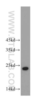 ABHD14B Antibody in Western Blot (WB)