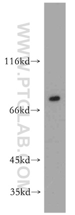 KCNJ1 Antibody in Western Blot (WB)