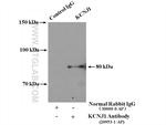KCNJ1 Antibody in Immunoprecipitation (IP)