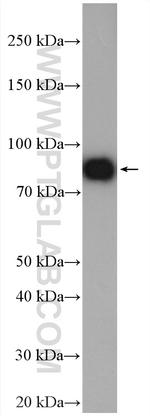 KCNJ1 Antibody in Western Blot (WB)